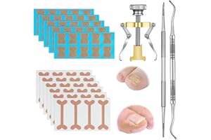 JBJXNXH 78 Pezzi Set di strumenti per la correzione dell'unghia del piede,Cerotto per la Correzione dellUnghia Incarnita,Correttore Unghia Incarnita Set Strumenti Trattamento per la Cura dellUnghia del Piede