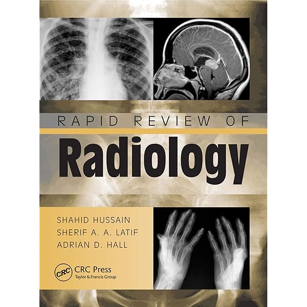 Accident and Emergency Radiology: A Survival Guide eBook
