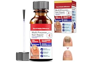 DIVIDERMY Trattamento Unghie Piedi, Riparatore Cura delle Unghie, Oli per la Cura Delle Cuticole, Rinforzante Unghie Fragili, Nutre e Lenisce Le Unghim, 30ml, Rosso