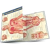 CHART-QUICKSTUDY TRIGGER POINT (Quick Study Academic)