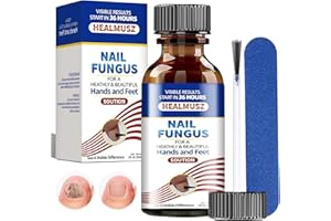 NACERLARY 30ml Liquido Riparatore per Unghie,Soluzione Idratante per Unghie Secche e Deboli,Riparatore Cura delle unghie,Migliora l'Aspetto delle Unghie,Nutre e Protegge la Lamina Ungueale