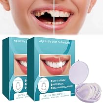 Faux Placages Dentaires Clip-On - Dent Temporaire Réglable - Cosmétique Dentaire Amovible - Ensemble