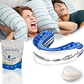 Schlafhimmel Schnarch- & Protrusionsschiene,schnarchfrei Pro,anti Schnarch Schiene,quiet Lab Anti Schnarch,anti Snoring Mouth