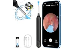 Oxbird Ear Wax Removal Kit Tool with Camera, 1080P Wireless Earwax Camera Ear Camera Otoscope Cleaner Smart Ear Cleaner with Camera and Light for iPhone, Ipad & Android Smart Phones (Black)