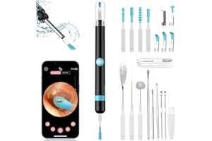 KAREBABE Ohrenschmalz Entferner Otoskop, Verbessertes Otoskop Kit mit 7 Massage Funktionen für Kinder Erwachsene, 1080P HD WiFi Ohrenentferner mit 6 LED-Leuchten Geeignet für Verschiedene Smart Geräte