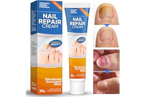 ATUIO Nágelréparãturcreme, Wirksame Zehênnágelpιlzbehãndlung Pïlzentferner Fußnãgelrepãraturcréme stellt das gesunde Aussehen der Nägél wieder her-20g