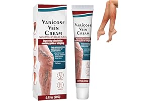 KOAHDE Vein Relief Cream,Varicose Vein Cream for Legs,Leg Varicose Ointment,Improve Blood Circulation,20g