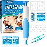 Skin Tag Removal Kit with 40 Bands, Auto Tool Kit Skin Tag Remover, Auto Skin Tag Removal Kit, (2mm-8mm) - Auto Fast-Acting S