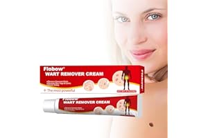 NAAONI Crema de eliminación de verrugas 20 gramos, eliminador de etiquetas cutáneas, adecuada para eliminar verrugas, verrugas comunes y planas para manos y plantas de pies