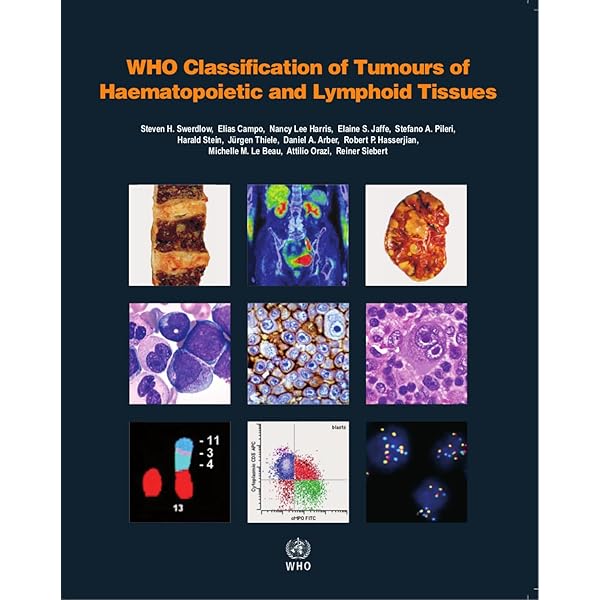 Who Classification of Tumours of Endocrine Organs (World Health Organization Classification of Tumours) [ペーパーバック] Lloyd， Ricardo V.、 Osamura， Robert Y.、 Kloppel， Gunter; Rosai， Juan World Health Organization Classification of Tumours of
