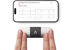 ‎ALIVECOR AliveCor KardiaMobile 6L - Smartphone-kompatibler 6-Messungen-EKG-Monitor - erkennt Vorhofflimmern in nur 30 Sekunden - egal wann und wo