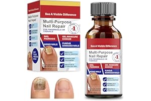 LURELUXE 30 ml Nagelhärter Nagelaufbauserum Nail Repair, Schützender Nagelhärter,Nagelhärter fur Brüchige Nägel, Fuß Flüssigkeit für Fingernägel und Fußnägel Nagelpflege