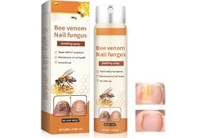 Biprodukt nagelreparationsspray med bikbehandling, propolis nagelserum, naglar reparationsserum, nageltillväxt och reparation