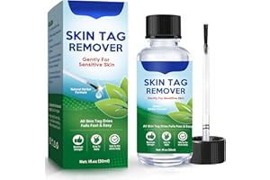 NIKURA Fibromi Penduli Rimozione