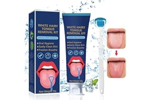 ‎MIIOTO Miioto Zungenreiniger, Zungenschaber, Tongue Cleansing Gel 50g+ Zungenbürste, Zungenreinigung&Mundpflege Beseitigt Mundgeruch und frischen AtemZungenreiniger (02)