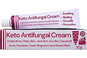 YOUDENT Antifungal Cream | Treats Itchy, Flaky Skin, Jock Itch, Dry Skin, Dandruff, Acne, Psoriasis, Yeast, Ringworm and Sweat Rash | 30g