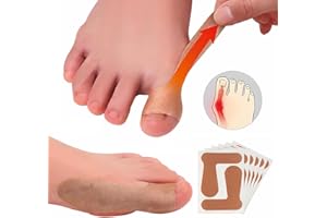 XULEGGNK Hallux Valgus Bandage, Hallux Valgus Korrektur, Zehenspreizer Hallux Valgus, Ballenzehen Korrektur, Bunion Corrector, Zur Verbesserung von Daumenschmerzen, 20 pcs