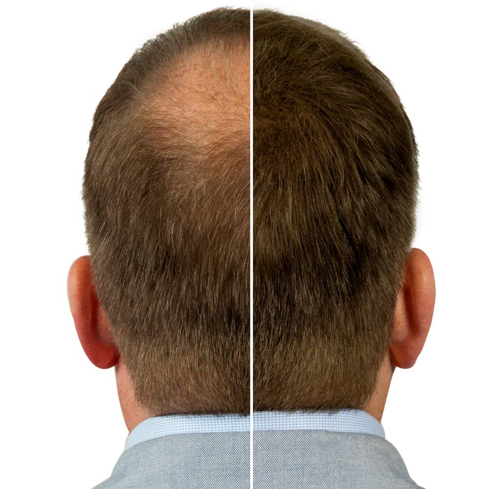 plus additional hair effektives