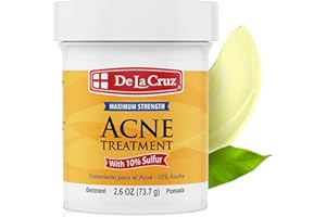 NEW MAX STRENGTH 10% SULPHUR OINTMENT SULFUR CREAM ACNE BLACKHEAD SPOT CYST ZIT CURE OILY SKIN BLOCKED PORES MEDICATED TREATMENT 2.6 oz by De La Cruz