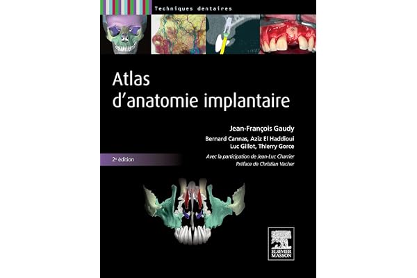 Atlas d'anatomie implantaire