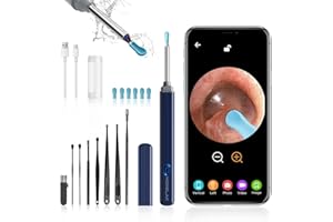 ‎MORELAX Earwax Remover, Ear Wax Remover with 1080P HD, Ear Cleaner with 8 Tools & 6 Ear Spoons, Portable Earwax Remover with LED Light for iOS/Android (Azure Blue)