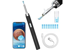 ‎HOFENY Ohrenschmalz Entferner Otoskop, HOFENY 5MP HD Ohrenreiniger mit 360° Weitwinkel-Ohr-Endoskop, WiFi Ohrenreiniger Kamera mit 6 LEDs, Ohr Endoskop Ohren Reinigung Ohrspiegel für Android/IOS/Harmony