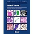 Thoracic tumours: Who Classification of Tumours: 5 (World Health Organization Classification of Tumours)