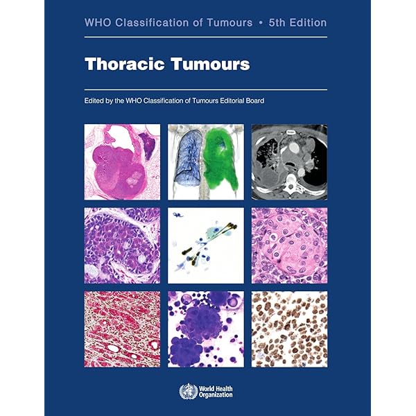 WHO Classification of Breast Tumours: WHO Classification of