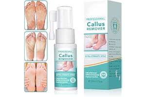 DOXENEM Professional Callus Remover Extra Strength Spray, Foot Callus Remover Extra Strength Spray, Instant Foot Peeling Spray, Foot Peeling Spray Oil for All Skin Types (1pcs)