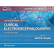 Epilepsy: a Comprehensive Textbook （3RD） Epilepsy: A Comprehensive Textbook