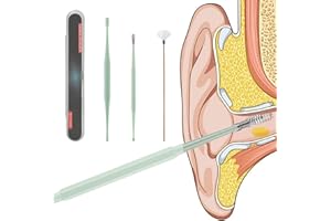 HMYCL Ohrenschmalz Entferner, Ohrenreiniger, New Sicheres und Weiches 360 Grad Spirale Silikon Ohrreiniger, Ohrenreinigung für Kinder und Erwachsene, mit Aufbewahrungskiste