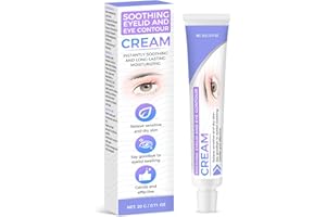 TIEPETLY Blepharitis Treatment Eye Cream, Stye Eye Treatment, Chalazion Treatment for Stye, Hydrating Treatment Under Eye Relief Moisturize, for Puffiness, Dryness, Swelling, Dark Circles
