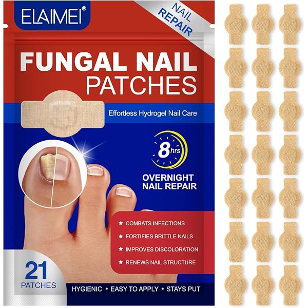 Nagel-Patches Zur Reparatur – 21 Stück, Einfach Anzuwenden, Pflegen Beanspruchte Nägel
