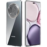 Cover Per Honor Magic 6 Lite 5G Con Placcatura Oro – Sottile, Trasparente E Morbida, Protezione Per Fotocamera - 3