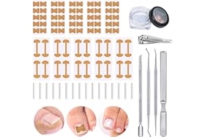 AURORAYER 105 Stück Eingewachsene Zehennägel Werkzeug Set Pediküre Set mit Nagelaufkleber,Nagelzange,Nagelschieber,Nagelfeile,C-Tubes aus Kunststoff enthält