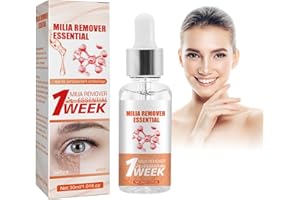Horuili® Schnelle Milienentferner, Milia Spot Behandlung für Auge, Milia Remover Essential, Entfernt Fettpartikel unter den Augen, Strafft und Festigt die Augenpartie und Reduziert feine Linien