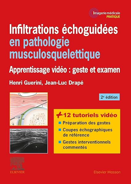 Amazon Fr Infiltrations Echoguidees En Pathologie Musculosquelettique Apprentissage Video Geste Et Examen Guerini Henri Drape Jean Luc Livres