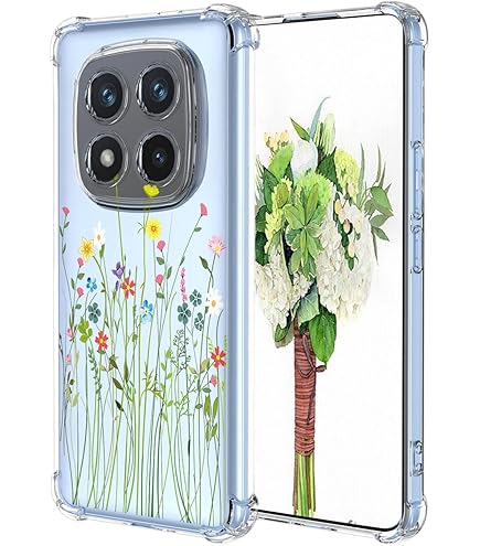 UPLAI Case For Xiaomi Redmi Note 14 Pro Plus 5G, Ultra Thin Shockproof Protection Cover With Electroplating Design, Premium TPU Bumper And Soft Silicone Stylish Durable Cover.(White