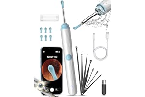 ‎KEKOY Kekoy Ohrenschmalz Entferner Otoskop mit Licht, 1296P Ohrenreiniger mit Kamera, WiFi Ohrreiniger mit Kamera, Wiederaufladbar Ear Cleaner, Ohrreiniger für Erwachsene und Kinder（Weiß Hellblau）