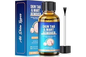 BOXMOM Wart Remover,Fast-Acting Skin Tag & Wart Remover for Feet & Hands,Skin Tag Removal Kit Effective Treatment for Plantar and Common Warts,Flat Warts,Corns,and Calluses Natural & Safe (30ML)