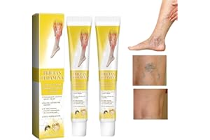 MAFHVV Bienengift Cream, Bienengift Krampfadern Creme, lindert müde und schwere Beine (2 Stück)