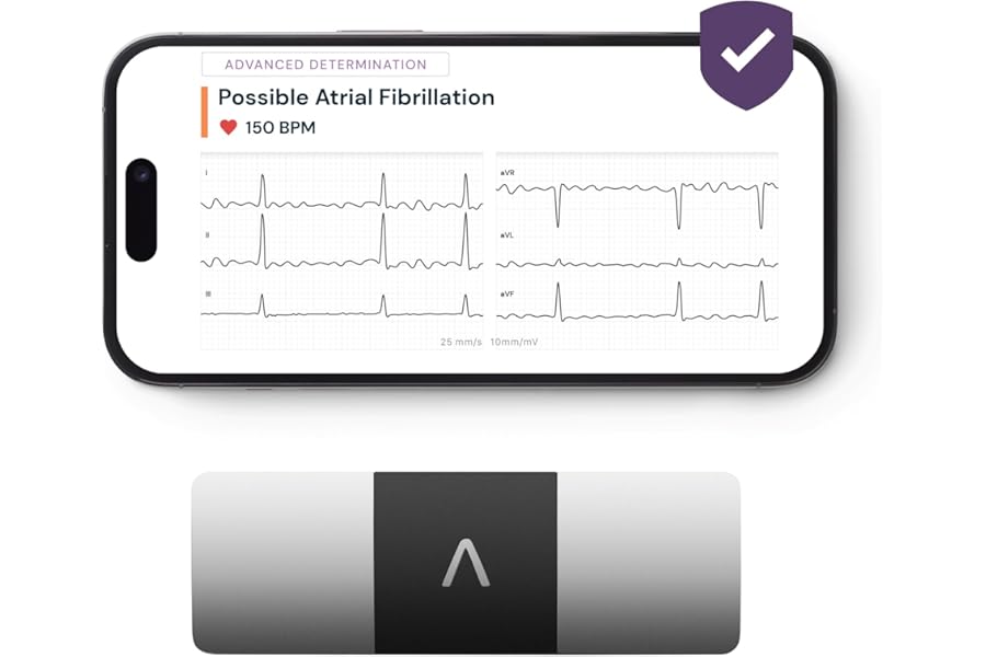 KardiaMobile 6-Lead Personal ECG Heart Rate Monitor + 1 Month Free of KardiaCare - Six Views of The Heart, Detects Atrial Fibrillation, Trusted by the NHS, Fast Results, Works with Most Smartphones