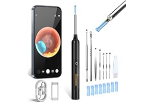 VITCOCO Otoscopio Per Pulizia Orecchie Wifi, Pulisci Orecchie 5MP HD Con 6 Luci LED E Punta Da 3,5mm, Pulitore Orecchie Impermeabile IP67, Compatibile Con iPhone, iPad E Smartphone Android (Nero)