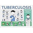 Anne Print Solutions® Tuberculosis Poster for Hospital | Clinic Pack of 1 Pcs Size 13 Inch X 19 Inch* Multicolour
