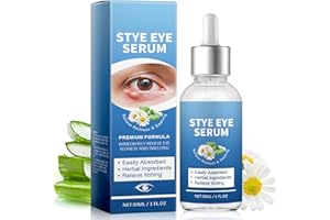 JOVIAL Stye Eye Treatment, Natural Stye Eye Relief Serum for Infected Styes, Chalazion and Blepharitis, Gentle Styes Eyes Serum Drops for Irritation and Restore Eyes Healthy