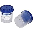 Sterilized 30ml Urine Container - Leak-Proof Lid for Precise Sampling in Medical and Laboratory Settings (Pack of 10)