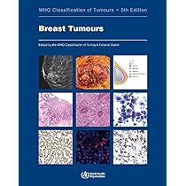 WHO Classification of Tumours. Digestive System Tumours: WHO
