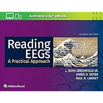 Epilepsy: a Comprehensive Textbook （3RD） Epilepsy: A Comprehensive Textbook