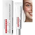 HIVETZ 15% Acid Acne Treatment Gel for Face, Spot Treatment, Dark Spot Remover, Brightening Serum, All Skin Types
