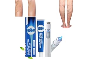 ASHOPFUN Blue Light Therapy Varicose Veins Pen/Cream,Vericose Veins Treatment Blue Light Treatment Pen,Varicose Veins Blue Light Therapy Set,Spider Vein Removal Pen,Blue Light Therapy Pen (1xcream+1xpen)